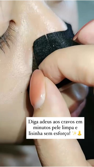 Remova cravos de forma prática, rápida e sem dor! CLIQUE E GARANTE ⬆️ #adesivofacial #pelesemcravos #cuidadoscomorosto #PorosLimpos